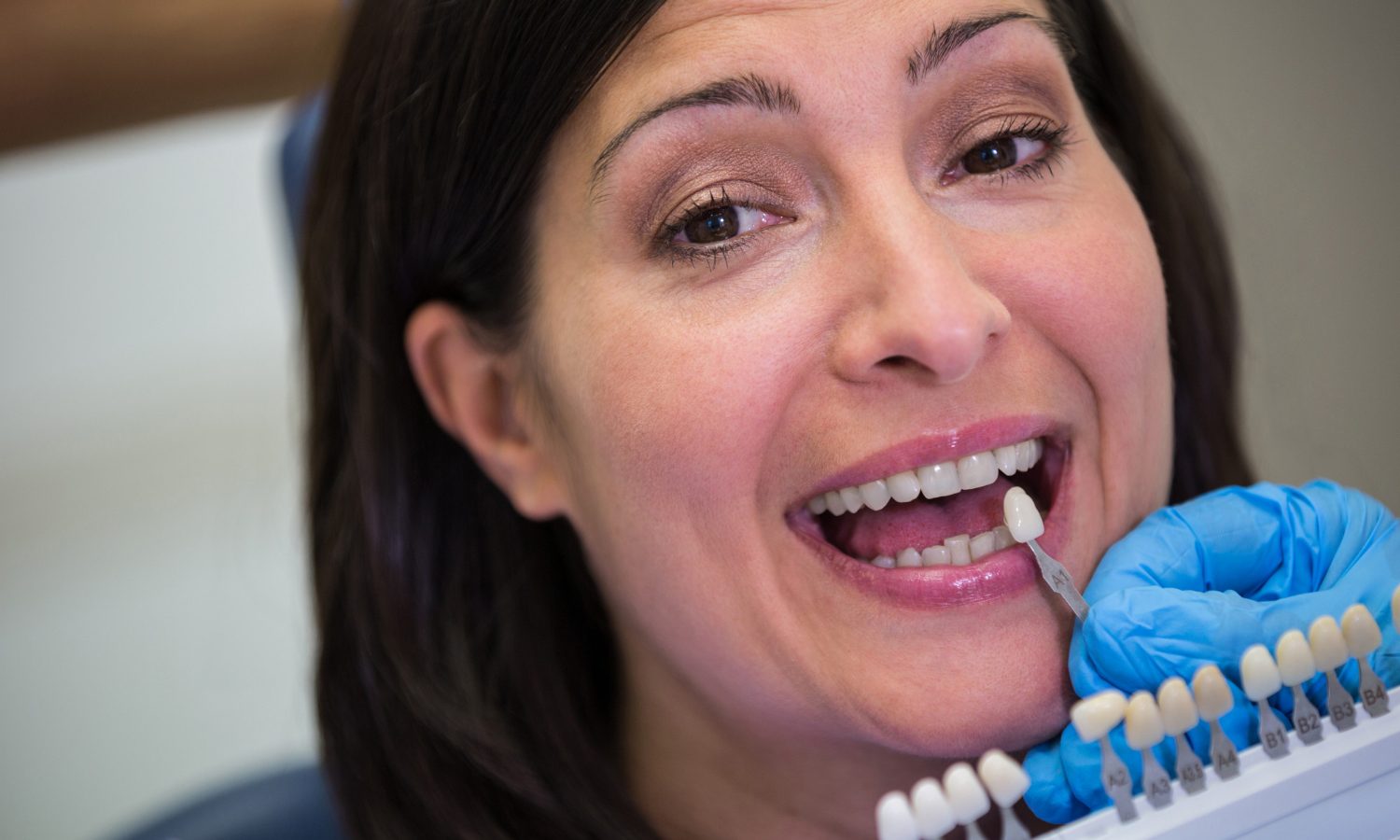 dental implant crown consultation Westminster CA
